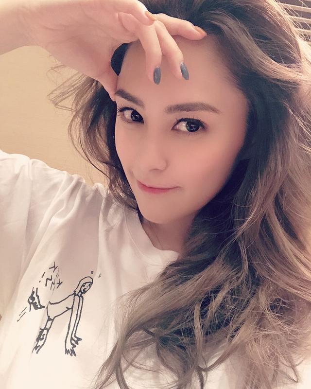 【最新】阿娇或需再做手术 有毁容的风险吗?前夫与美女健身遭炮轰