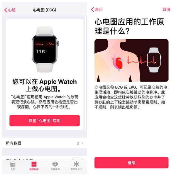 苹果手表EGG心电功能将于日本上线