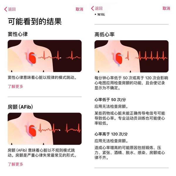 苹果手表EGG心电功能将于日本上线