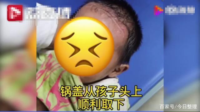 令人窒息！男孩脑袋卡进锅盖取不下来，医院无奈只有求救消防