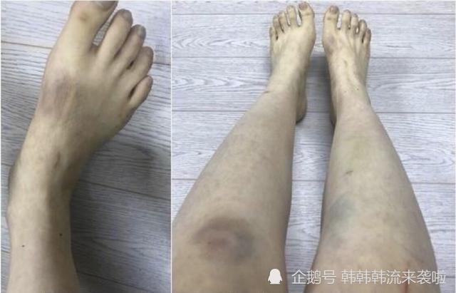 【震惊】具荷拉前男友终审获刑1年 