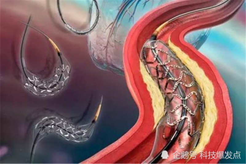 【新发现】科学家发现人类新器官 未来人类会进化成为什么样？