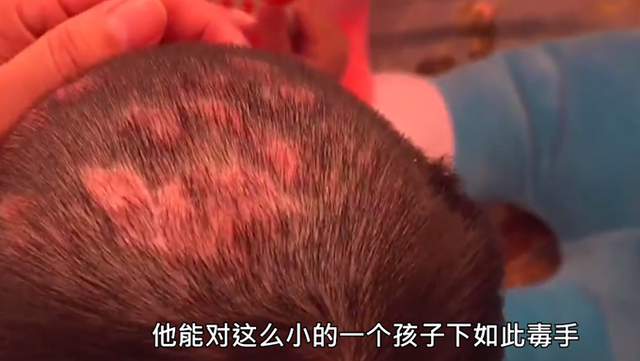 【持续发酵】抚顺市回应6岁女童受虐案 抚顺被虐女童首诊医生发声
