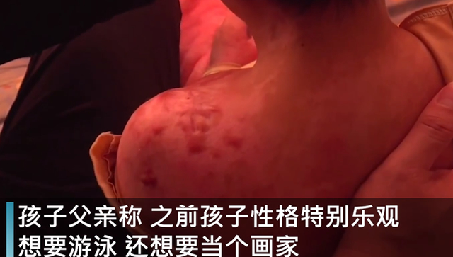 【持续发酵】抚顺市回应6岁女童受虐案 抚顺被虐女童首诊医生发声