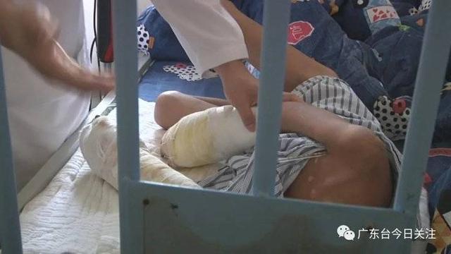 【丧心病狂】男童遭亲父烟头烫伤双手面临截肢，病房里传出凄惨哭声