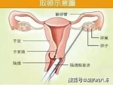 荒唐！18岁女大学生15万卖卵子 到底发生了什么？