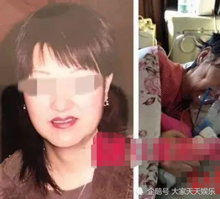 女商人抽脂成植物人10年后死亡，真相到底是什么？