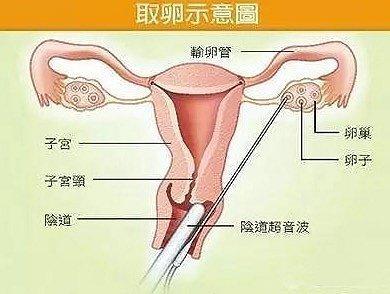 非法代孕产业链真相令人震惊！央视评代孕弃养:法律道德皆难容