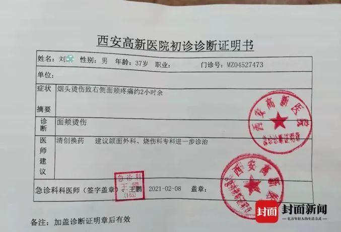 西安警方通报职员遭高管烟头烫脸 怎么这么残忍！