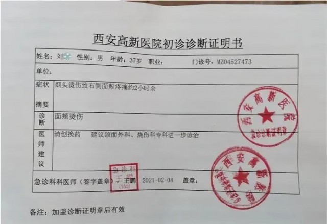 公司高管用烟头烫员工脸！面对职场霸凌该怎么做？