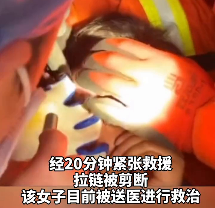 杭州一女子眼皮被拉链夹住求助消防，到底发生了什么？
