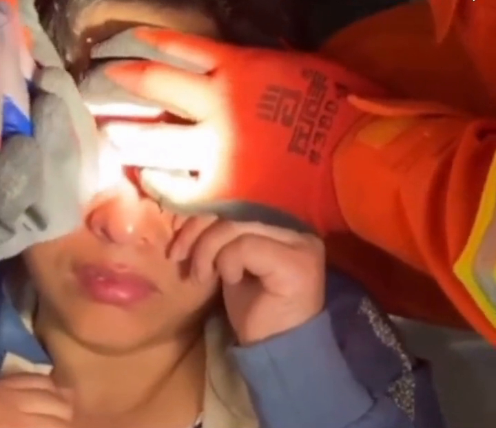 看着都疼！杭州一女子眼皮被拉链夹住求助消防，到底发生了什么？