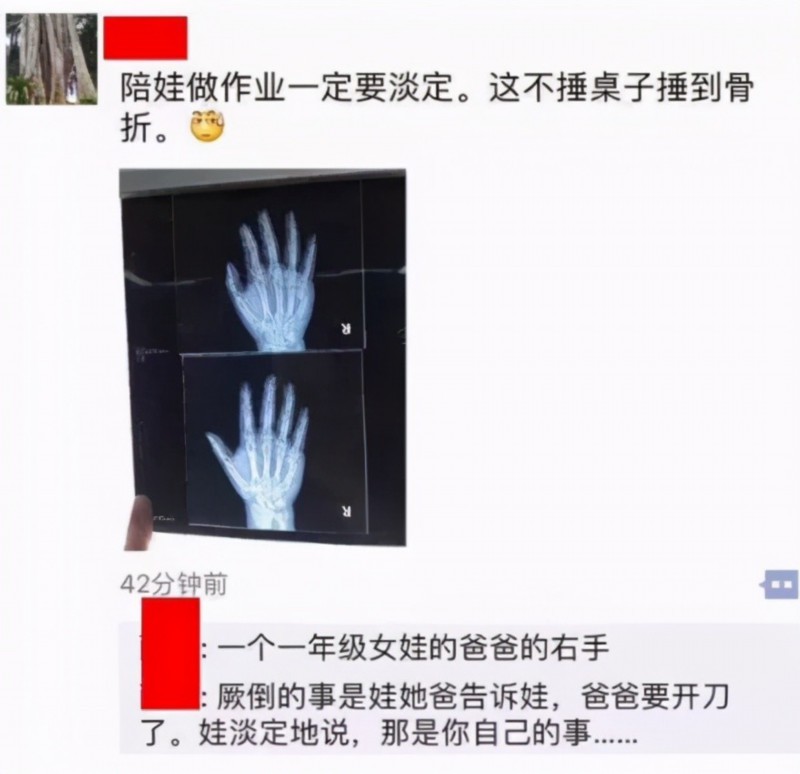 一写作业鸡飞狗跳!爸爸辅导孩子作业生气捶墙致骨折 网友分享心酸“血泪史”
