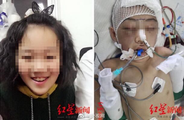 继母虐打女童致脑梗死一审判无期，当庭上诉！女童父亲：没答应谅解