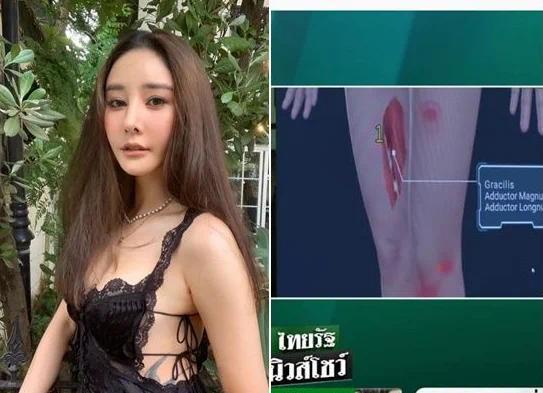 目击者曝泰国女星Tangmo死状惨烈 医生怀疑其生前遭到绳索捆绑