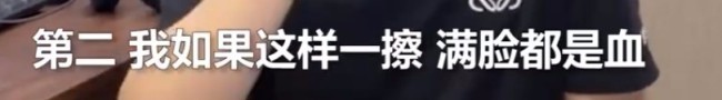 敬业！主持人回应流鼻血仍淡定播新闻 事件回顾