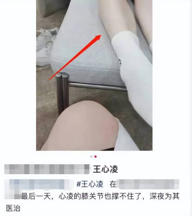 王心凌回应录节目受伤：已经获得照顾 不要担心