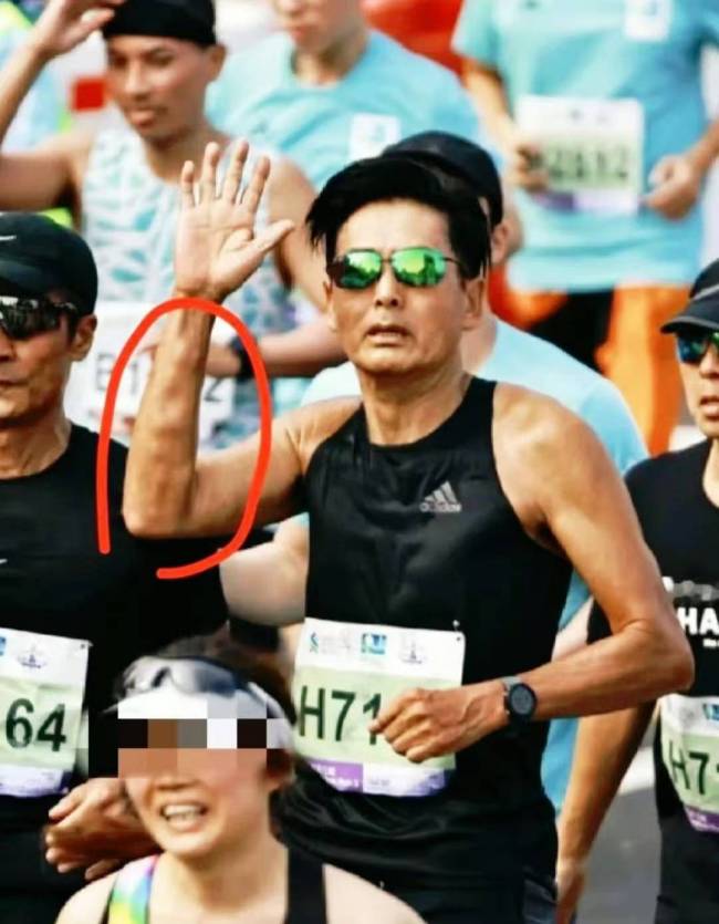 周润发否认患肿瘤：那些小肉球其实是皮下脂肪