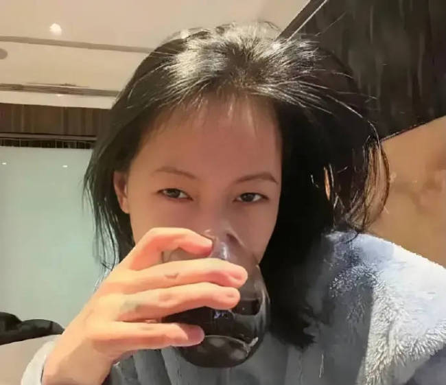 小S通过经纪人回应肝脏出问题：肝很正常